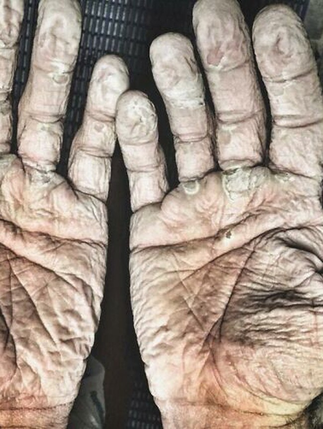 Asli! Ini Foto Kondisi Tubuh Manusia yang Bikin Merinding