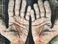 Asli! Ini Foto Kondisi Tubuh Manusia yang Bikin Merinding