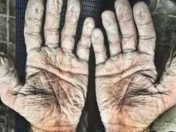 Asli! Ini Foto Kondisi Tubuh Manusia yang Bikin Merinding