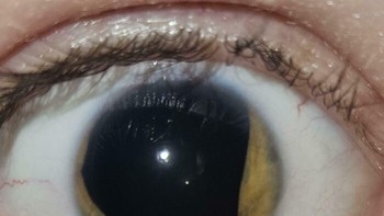 Seseorang yang nyaris tidak memiliki warna mata. Foto: Boredpanda