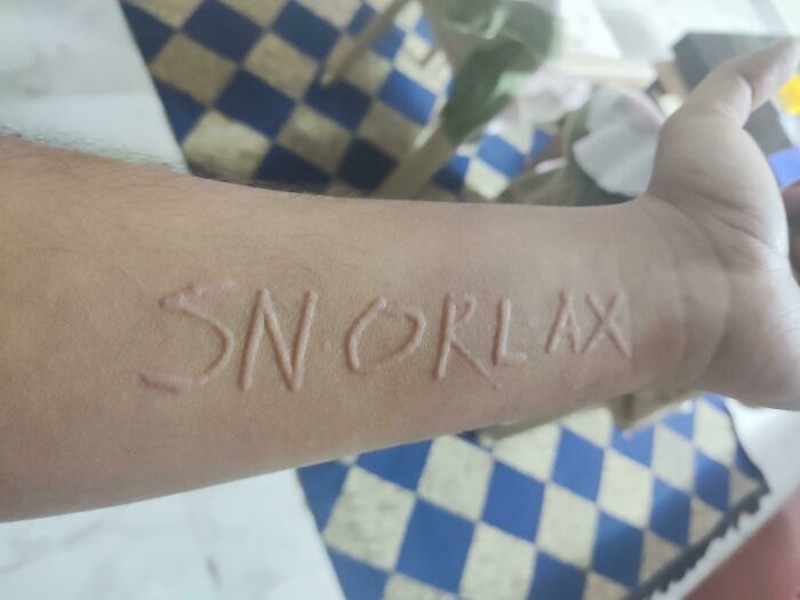 Kondisi Tubuh yang Mengejutkan