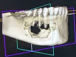 Kondisi Tubuh Manusia Ini Bikin Takjub dan Merinding