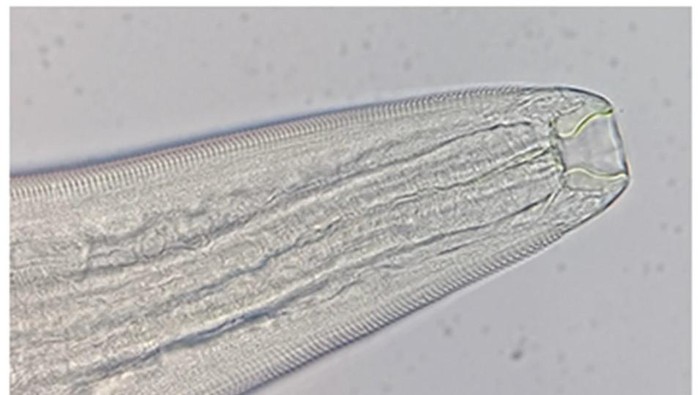 Penampakan cacing yang sembunyi di mata.