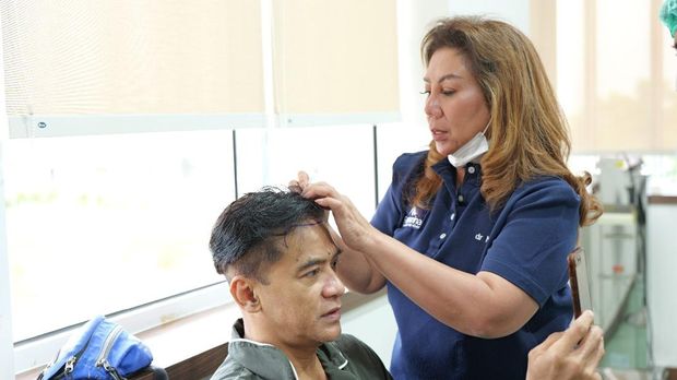 Donny Damara melakukan treatment PRP (Platelet Rich Plasma) dan transplantasi rambut.