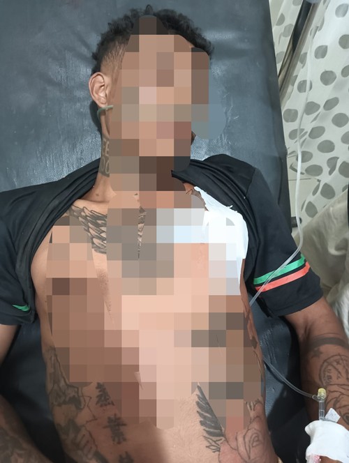 Arkadius Nahak (22), korban penikaman di sebuah rumah duka di Desa Boronubaen, Kecamatan Biboki Utara, TTU, NTT, saat dirawat di RSUD Kefamenanu. (Dok. Polres TTU)