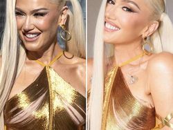 Editan Foto Seleb Ini Ketahuan, Perbedaannya Terlalu Jelas!