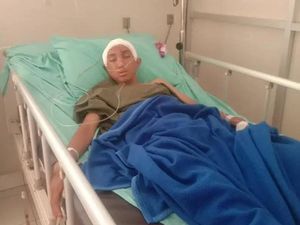 Nahas Pemuda Cimahi Dilempari Batu Sekelompok Remaja hingga Kepala Retak