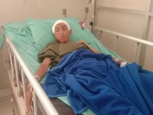 Luka Fatal di Kepala yang Bikin Remaja Cimahi Terbaring Tak Berdaya