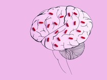 Pilu Terserang Stroke di Umur 21, Ini 6 Kebiasaan yang Bisa Jadi Pemicu