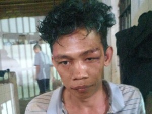 Ardiansyah Babak Belur Dimassa Usai Terciduk Curi Motor Lalu Bacok Korban