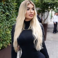 Perubahan drastisnya itu juga sempat membuatnya tertahan di bandara internasional São Paulo. Petugas imigrasi sempat ragu dengan identitas Janaina karena wajahnya jauh berbeda dari foto paspor lamanya. Saya sudah menduga hal ini bisa terjadi suatu saat, tapi tetap saja kaget dan malu saat itu, ujarnya.  Foto: dok. Instagram @janaina3