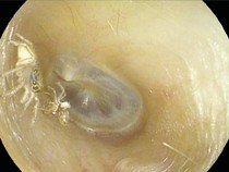 Bikin Merinding! Dokter Temukan Kecoa hingga Laba-laba di Tubuh Manusia