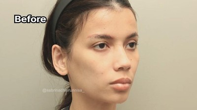 7 Foto Before-After Sabrina Istri Deddy Corbuzier Jalani Fat Graft