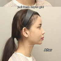 Sabrina juga membagikan foto wajahnya setelah menjalani prosedur fat graft. Jadi lebih berisi wajah Sabrina tampak semakin fresh, membuatnya terlihat lebih awet muda. Foto: Instagram/@sabrinachairunnisa_