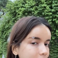 Sehari setelah tindakan wajahnya pun terlihat normal tanpa lebam, hanya ada beberapa bekas suntikan dan plester yang masih menempel. best decision ever sih fat graft ke mukaku yang dari super tirus dan cekung jadi lebih ke isi, lebih fresh tanpa takut geser2 kaya filler dan hasilnya lebih NATURAL. Karena ini pake our own fat. Dan fat yg di ambil dan di suntik tu ga banyak.. cuman 20-30 cc jg max yang udah ready siap di injeksi ke muka, tulisnya di keterangan unggahan. Foto: Instagram/@sabrinachairunnisa_