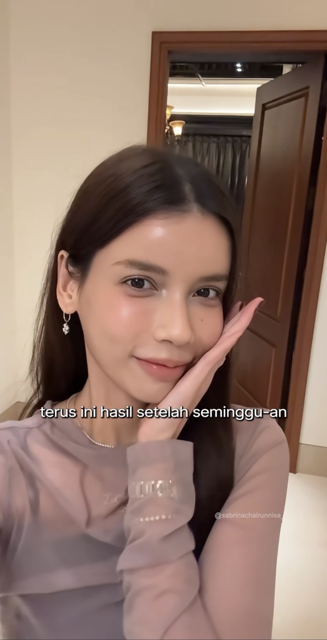 Setelah seminggu wajah Sabrina terlihat makin glowing dan cantik natural. Penampilan wanita 32 tahun itu pun jadi semakin fresh. Foto: Instagram/@sabrinachairunnisa_