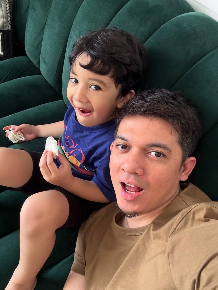 Irwansyah Irwansyah patah kaki.