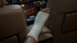 Irwansyah Patah Kaki saat Asyik Main Bareng Anak