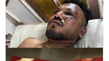 Vishwashkumar Ramesh warga negara Inggris, adalah satu-satunya penumpang selamat dalam kecelakaan pesawat Air India. Kisah warga Inggris Vishwashkumar Ramesh dari Leicester, yang duduk di kursi 11a, menjadi penyintas satu-satunya dengan hanya beberapa luka, sungguh menakjubkan, tulis presenter kenamaan Piers Morgan. Foto: X.com