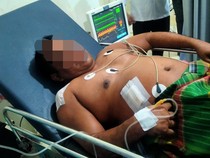 Pegawai SD di Sumba Tikam ASN Disdikpora hingga Terluka Parah