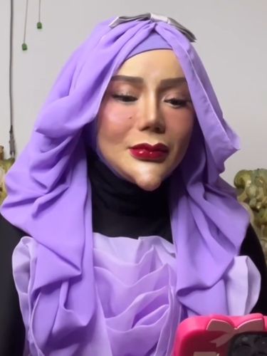 Beredar video viral di media sosial, TikToker dan PNS asal Lampung, Yuni Jasmine yang kerap menggunakan filter dengan memamerkan dagu lancipnya. Kini tampil tanpa filter.