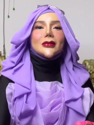 Beredar video viral di media sosial, TikToker dan PNS asal Lampung, Yuni Jasmine yang kerap menggunakan filter dengan memamerkan dagu lancipnya. Kini tampil tanpa filter.