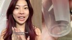 10 Benda Nyangkut di Tenggorokan hingga Tertelan, Ada Sikat Gigi di Lambung!