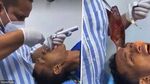 10 Benda Nyangkut di Tenggorokan hingga Tertelan, Ada Sikat Gigi di Lambung!