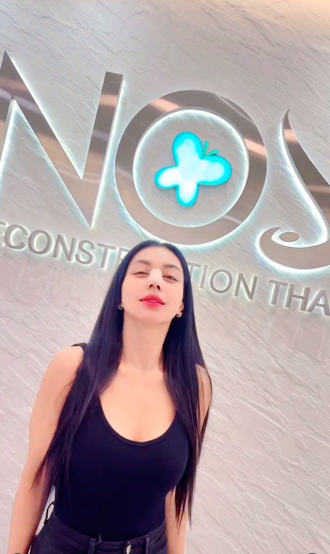 Melalui akun Instagram pribadinya Denada membagikan penampilan terbaru dirinya usai menjalani rhinoplasty di Thailand. New me, unlocked, tulisnya dalam keterangan video singkat unggahan. Foto: Instagram/@denadaindonesia
