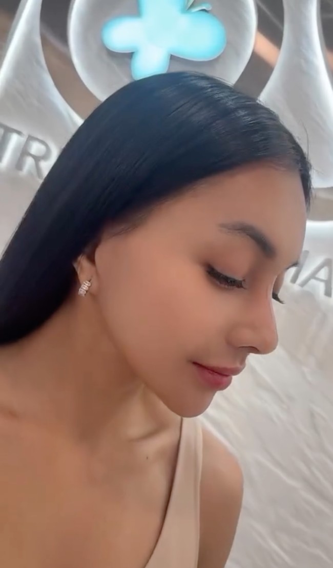 Sudah buka perban, hidung Denada kini tampak jauh berbeda. Jadi lebih mancung, hal itu juga mempengaruhi keseluruhan tampilan wajahnya, membuat Denada jadi bak beda orang. Foto: Instagram/@denadaindonesia