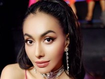 Denada Soal Penampilan Usai Operasi Hidung di Thailand