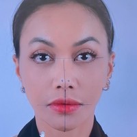 Sebelum menjalani oplas, Denada juga melakukan beragam pemeriksaan. Bagian hidungnya diukur dan digambar untuk menentukan bentuk seperti apa yang diinginkan Denada. Foto: Instagram/@denadaindonesia