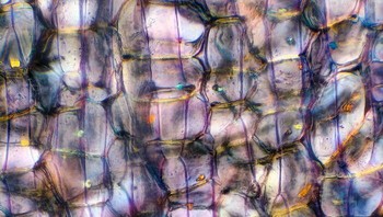 Lapisan Bawang di Bawah Mikroskop Foto: Boredpanda