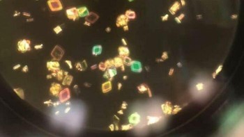 Kristal Asam Urat pada Sampel Urin Terlihat Melalui Mikroskop Foto: Boredpanda