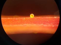 Dilihat Pakai Mikroskop, Tampilan Benda Ini Bikin Shock!