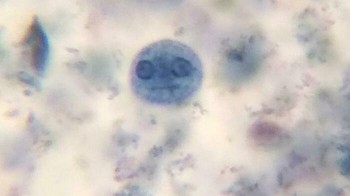 Amoeba Dilihat Melalui Mikroskop Foto: Boredpanda