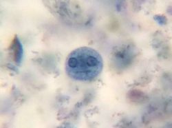 Dilihat Pakai Mikroskop, Tampilan Benda Ini Bikin Shock!