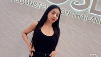 Belum lama ini Denada menunjukkan tampilan wajah baru usai operasi rhinoplasty di Thailand. Hasil operasinya pun bikin pangling karena hidung yang semakin mancung. Foto: Instagram @denadaindonesia