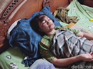Pulang dari Mal, Ibu-Anak di Palembang Dijambret hingga Alami Luka Parah