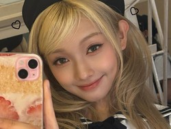 Idol KPop Bantah Oplas, Ungkap Perawatan Ini yang Bikin Wajahnya Lebih Tirus