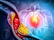 11 Tips Turunkan Kolesterol Tinggi agar Terhindar dari Pemicu Penyakit Serius