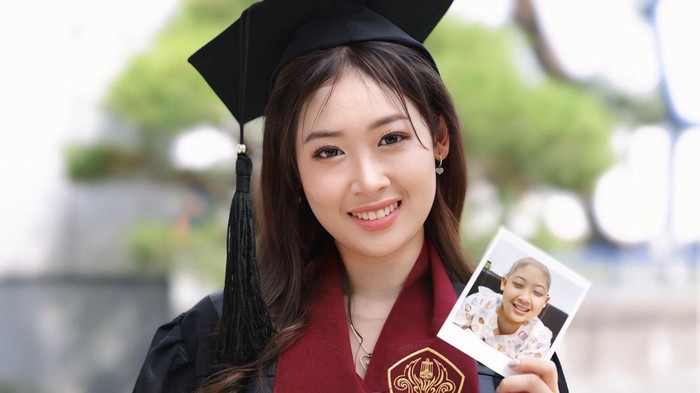 Perjalanan Michelle Penyintas Leukemia, Jalani Lebih 100 Kali Kemo untuk Sembuh