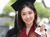 Perjalanan Michelle Penyintas Leukemia, Jalani Lebih 100 Kali Kemo untuk Sembuh