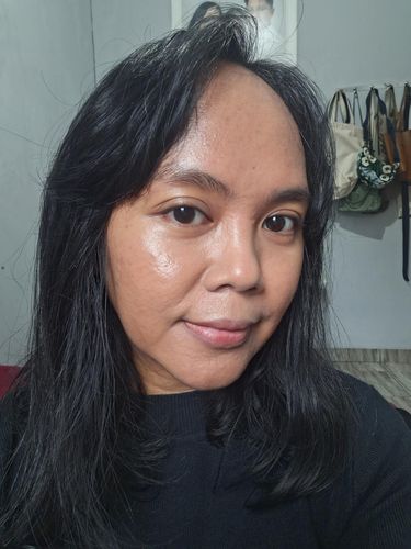Hasil kombinasi Skin Booster Salmon DNA dan Pico Laser setelah dua minggu.