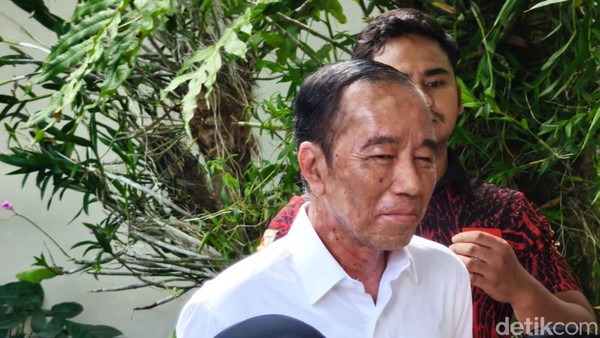 Potret Jokowi Idap Alergi Kulit