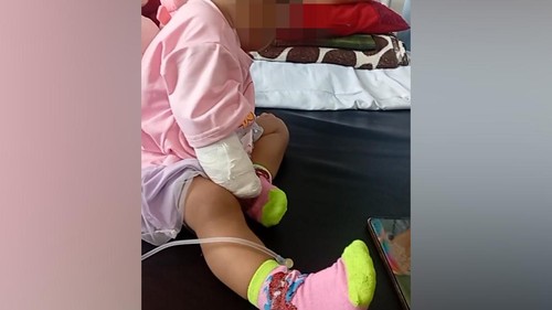 Tangan kanan balita bernama Arumi Aghnia Azkayra terancam diamputasi. Balita berusia 14 bulan itu memprihatinkan karen diduga menjadi korban malapraktik.

Berdasarkan pemeriksaan dan observasi laboratorium, tangan kanan Arumi mengalami infeksi parah.