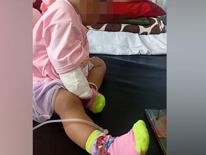 Video Nestapa Balita di Bima: Diduga Kena Malapraktik Berujung Tangan Diamputasi