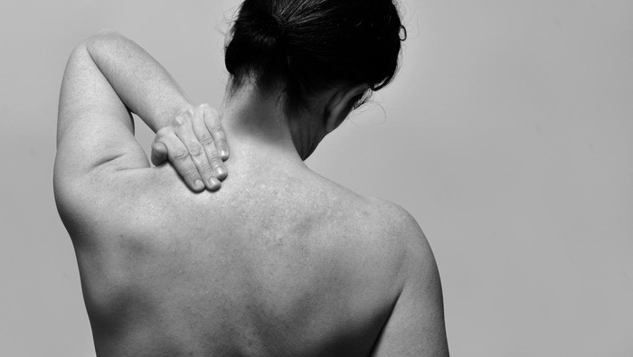 Stop Kaitkan Penyakit Kulit dengan Azab! Dokter Tegaskan Tak Ada Hubungannya