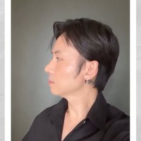 Dilihat dari samping bagian hidung Rafael kini jadi jauh lebih mancung dan ramping. Foto tersebut diambil setelah hampir 2 bulan pasca operasi, sehingga bengkak di wajahnya sudah hilang. Foto: Instagram/@rafaell_16