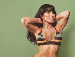 7 Foto Before-After Artis Korban Filler Abal-abal, Wajah Rusak Tak Dikenali